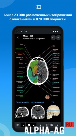 IMAIOS e-Anatomy screenshot 3