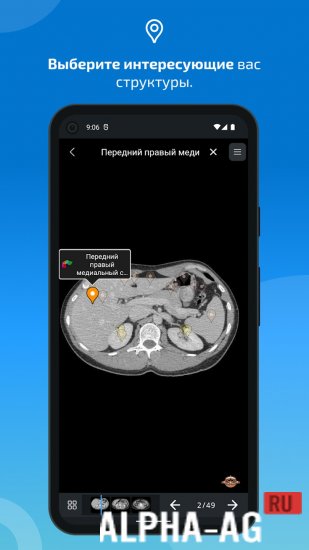 IMAIOS e-Anatomy screenshot 5