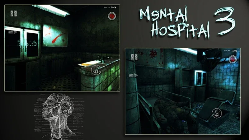 Mental Hospital III Remastered screenshot 2