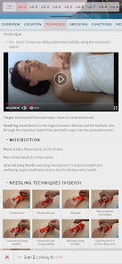 Acupuncture Atlas 3D screenshot 2