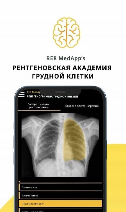 Chest X-ray screenshot 1