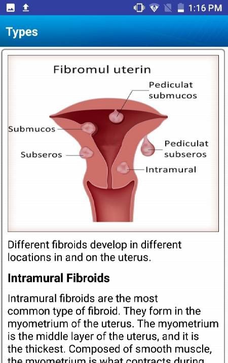 Uterine Fibroid Treatment Help screenshot 3