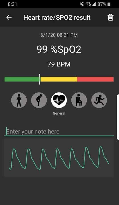 Pulse Oximeter - Beat & Oxygen screenshot 1