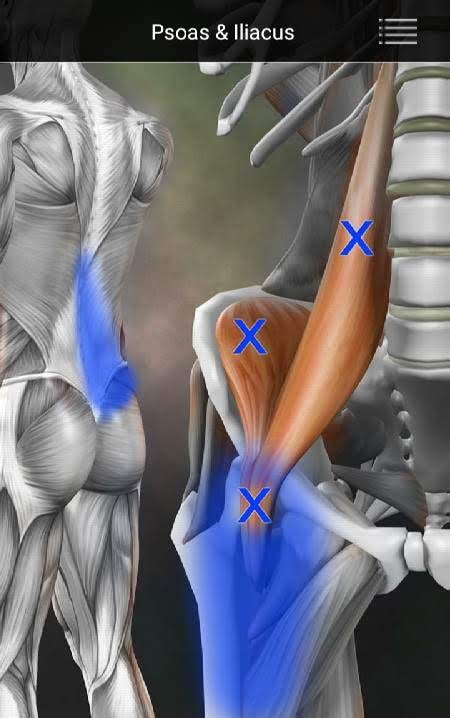 Muscle Trigger Point Anatomy screenshot 3