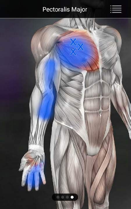 Muscle Trigger Point Anatomy screenshot 2