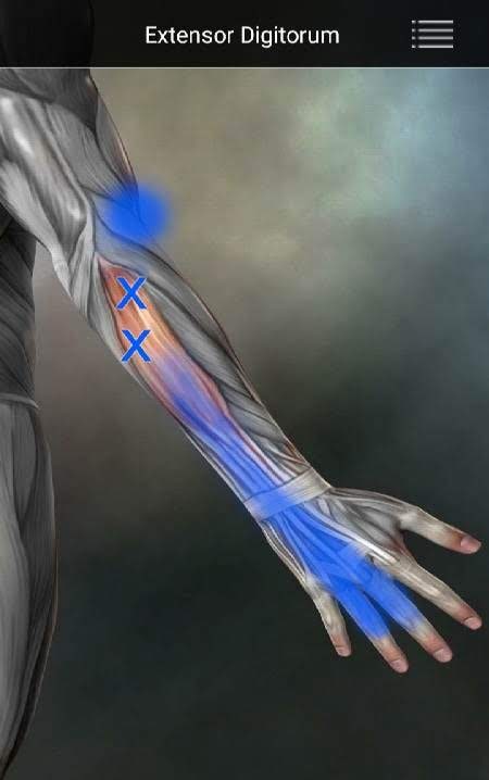Muscle Trigger Point Anatomy screenshot 4