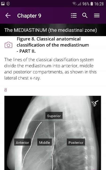 Discover Radiology: Chest X-Ray Interpretation screenshot 2