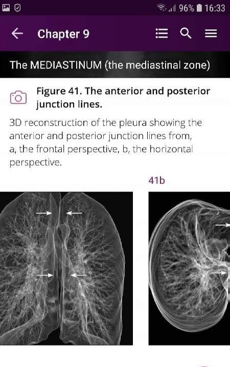 Discover Radiology: Chest X-Ray Interpretation screenshot 4