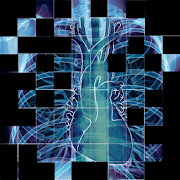 Discover Radiology: Chest X-Ray Interpretation