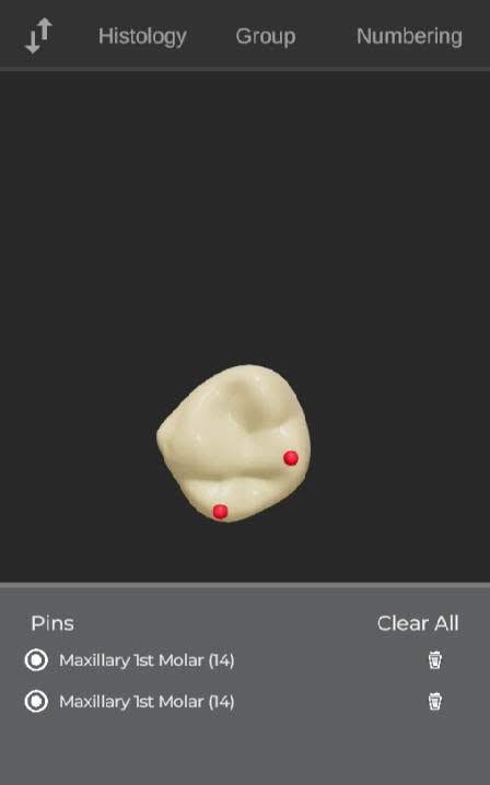 ToothView™ screenshot 4