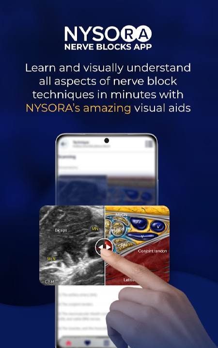 NYSORA Nerve Blocks screenshot 2