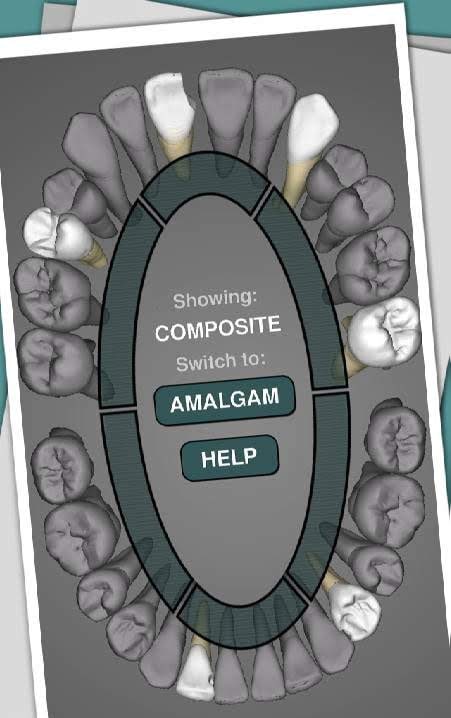 CavSim: Dental Cavity Trial screenshot 3
