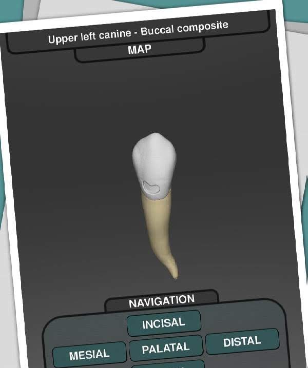 CavSim: Dental Cavity Trial screenshot 2