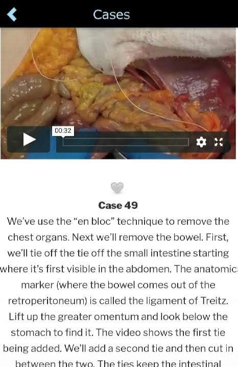 Autopsy screenshot 4