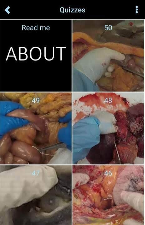 Autopsy screenshot 2
