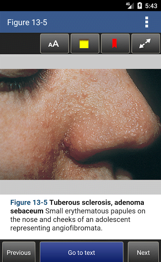 Color Atlas & Synopsis of Pediatric Dermatology 3E screenshot 4