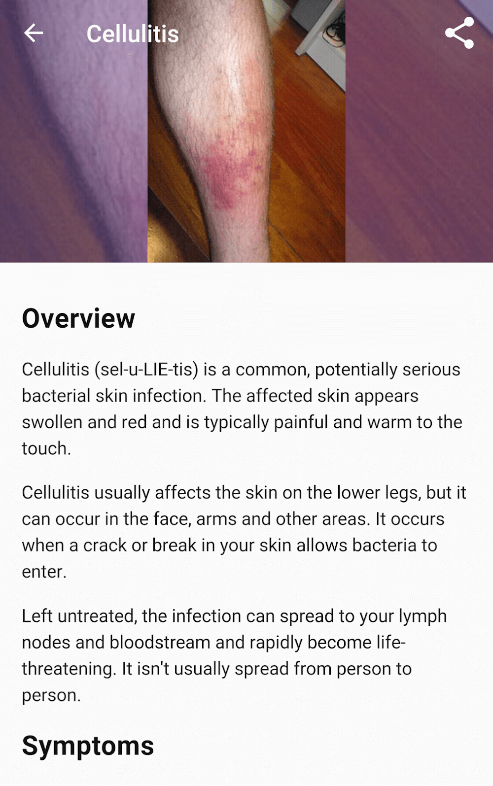 Diseases Dictionary screenshot 6